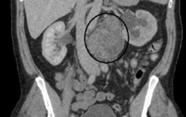 Lesson of the Month: Are we Missing the Mark(Er)?