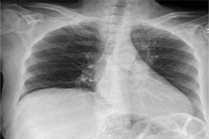 Jamaica Program Against Cancer