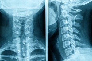 Covid: Desist Dire Discombobulation! Nothing Novel, Several Subtle Septic Strains Shall Still Surely Surreptitiously Surface!